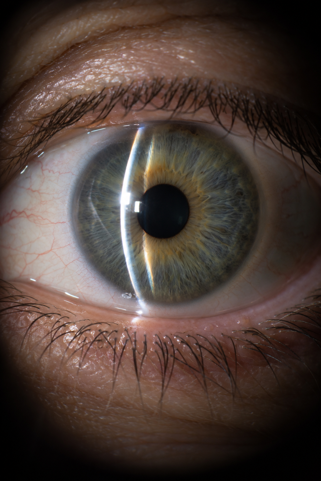 Tonometria Warszawa - pomiar ciśnienia oczu w Eyefinity.